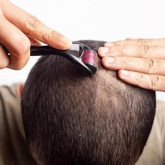 “Detén la caída y estimula el crecimiento del cabello y barba desde casa”